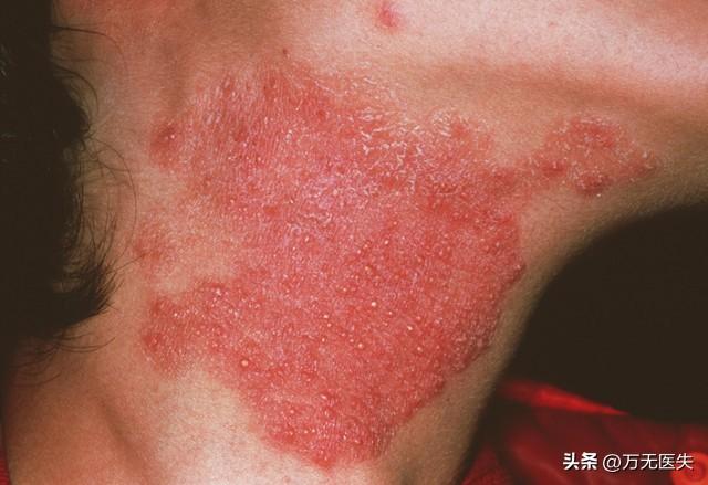 米兰体育810万中锋遭放弃 老鹰公牛成下家